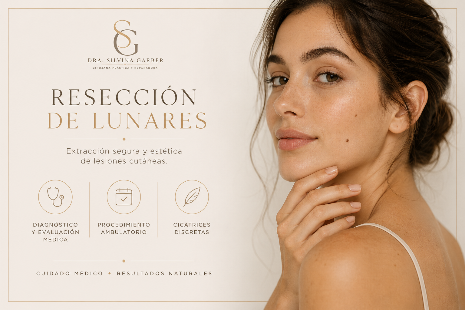 Resección de Lunares